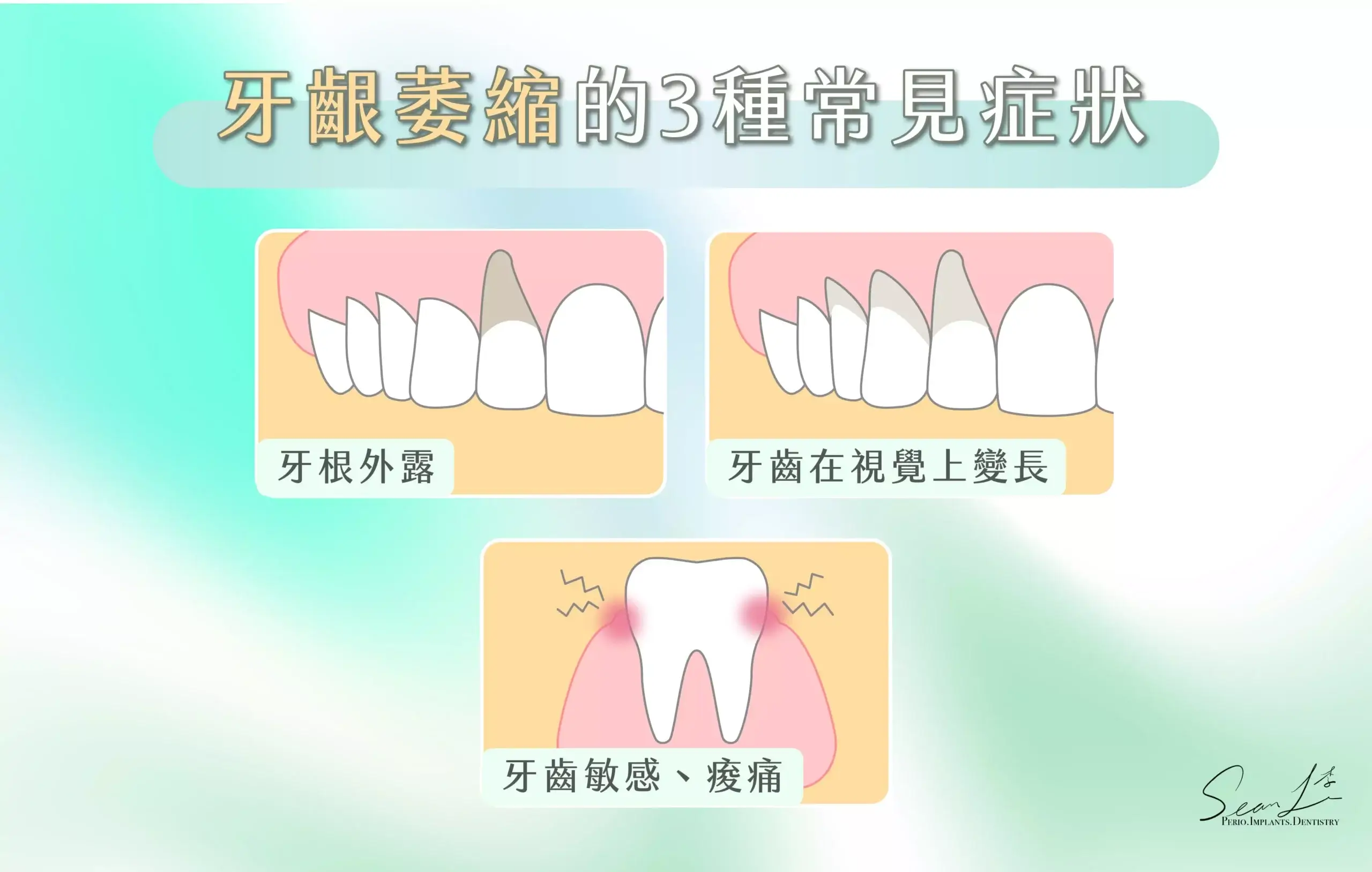 牙齦萎縮的3種常見症狀