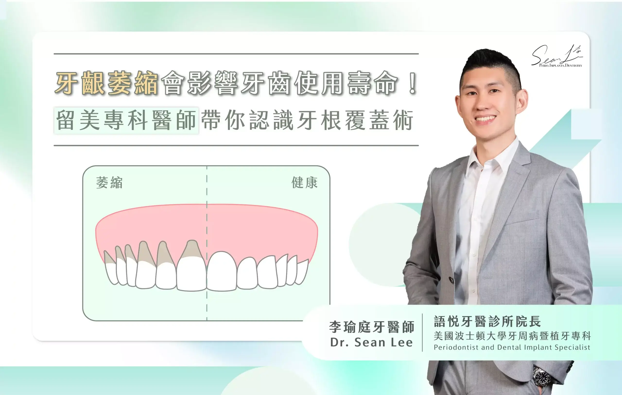 牙齦萎縮會影響牙齒使用壽命！留美專科醫師帶你認識牙根覆蓋術