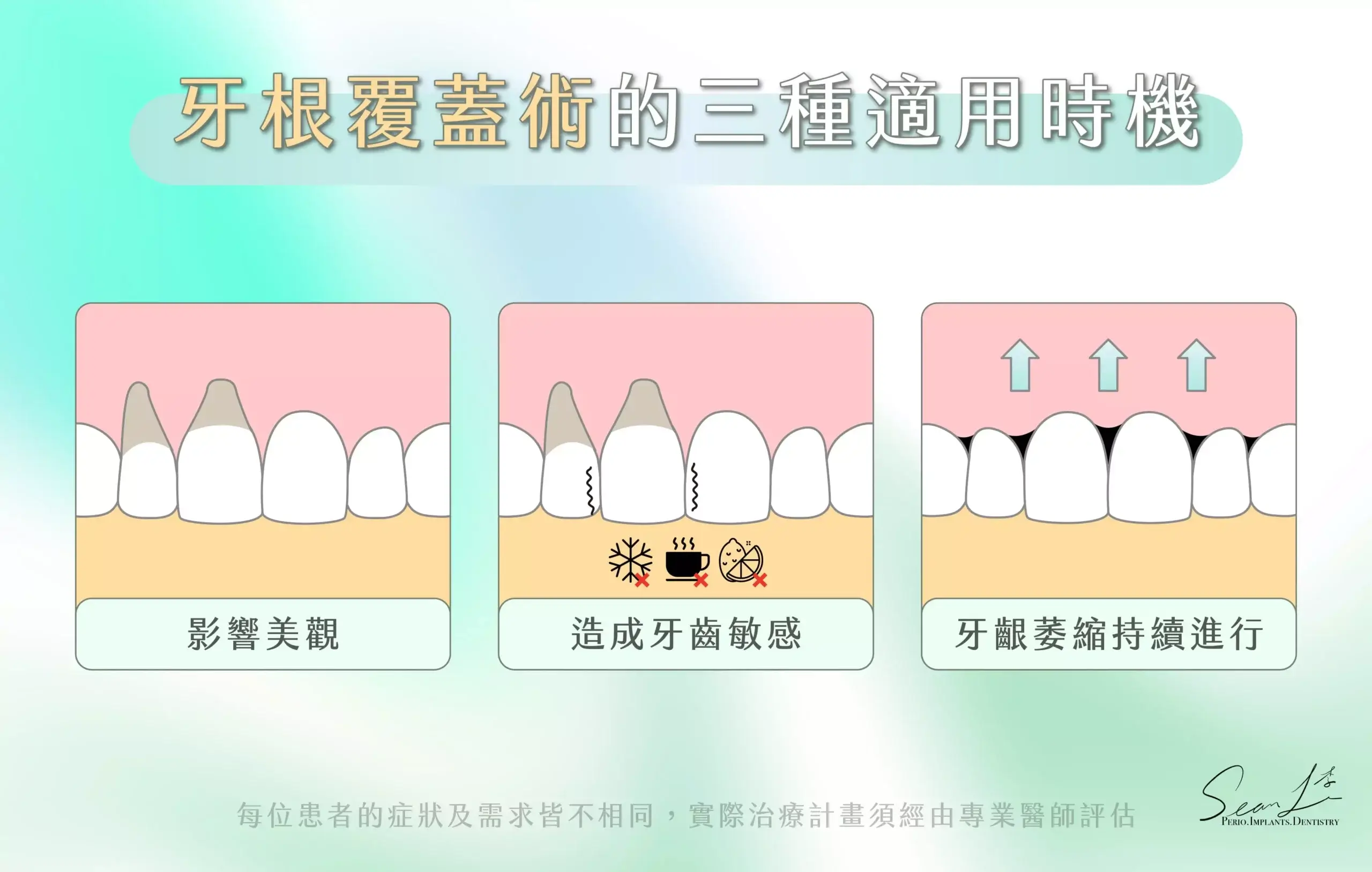 牙根覆蓋術的三種適用時機：影響美觀、牙齒敏感、牙齦持續萎縮